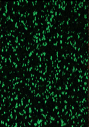 多彩熒光彈性顆粒